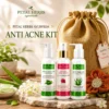 anti acne kit gift pack